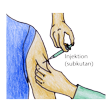 Illustration: Subkutane Injektion am Oberarm 