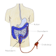 Illustration: Schematische Darstellung: Endoskop wird über Mastdarm in Kolon eingeführt