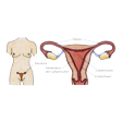 Illustration: Lage der Eierstöcke im weiblichen Körper und schematische Darstellung: Eierstock, Eileiter, Gebärmutter, Schleimhaut, Muskulatur der Gebärmutter