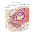 Illustration: Schnittzeichnung durch Unterleib einer Schwangeren: Scheide, Gebärmutter, Fruchtblase, Mutterkuchen
