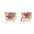 Illustration: Schnittzeichnung durch männlichen und weiblichen Unterleib: Harnröhre, Blase, Darm, beziehungsweise: Harnröhre, Blase, Gebärmutter, Darm