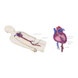 Illustration: Schemarische Darstellung von Herzkatheter im Körper durch Leistenarterie, und Schnittzeichnung durch Herz mit Katheter durch Aorta und Katheterspitze in linker Herzkammer