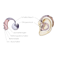 Illustration: Hörgerät und sein Sitz im Ohr: Ohrpassstück, Schallschlauch, Lautstärkeregler, Telefonspulenschalter, Batterielade, Ein- und Ausschalter