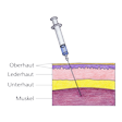 Illustration: Schematische Darstellung: Intramuskuläre Injektion durch Ober-, Leder- und Unterhaut in Muskel