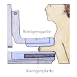 Illustration: Weibliche Brust wird zur Untersuchung zwischen Röntgenquelle und Röntgenplatte gelegt