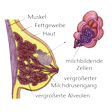 Illustration: Schnittzeichnung durch weibliche Brust: Haut, Fettgewebe, Muskel, vergrößerter Michdrüsengang, vergrößerte Alveolen mit milchbildenden Zellen