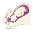 Illustration: Schnittzeichnung durch Unterleib einer Schwangeren: Nabelschnur liegt zwischen Geburtskanal und Kind