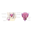 Illustration: Schnittzeichnung durch männlichen Unterleib und schematische Darstellung Prostata: Die Harnleiter münden in die Harnblase, an der sich Samenblasen befinden, von denen der Samenleiter zum Hoden abgeht. Die Prostata befindet sich unterhalb der Harnblase und umgibt den Beginn der Harnröhre