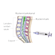 Illustration: Schematische Darstellung Punktion des Wirbelkanals: Auf Höhe der Lendenwirbelsäule (zwischen drittem und viertem Lendenwirbel) wird der Liquor im Rückenmarkskanal punktiert
