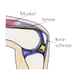 Illustration: Schnittzeichnung durch Knie: Sehne verbindet Oberschenkelmuskel und Scheinbein, verläuft über Kniescheibe